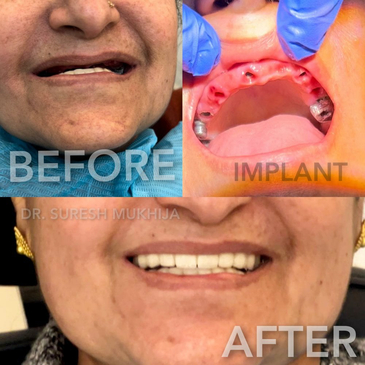 Slider image (5) THE DENTAL PORT